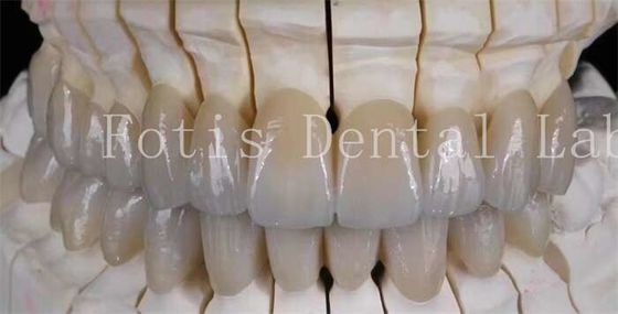 ยิ้มที่ดูธรรมชาติ โปรเทสเซลิน แลมเนตฟูเนียร์ ผิวเรียบ