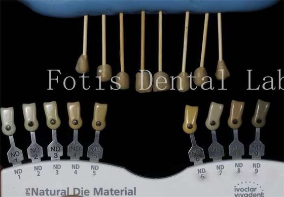 ทนทาน 0.3-0.5 มิลลิเมตร หนาฟัน Lab Veneers ฟันเทียม Veneers สําหรับฟัน