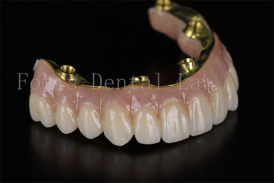ซื้อ การปรับปรุงฟากเต็ม All On 4 All On 6 ระบบปลูกฟัน online manufacture