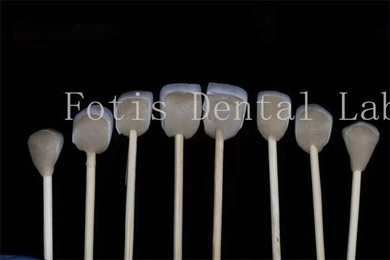 การปรับปรุงฟัน Lab Laminate Veneers ความเหมาะสมกับการปรุงฟันต่าง ๆ