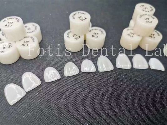 การปรับปรุงฟัน Lab Laminate Veneers ด้วยความทนทานและความแข็งแรงสูง