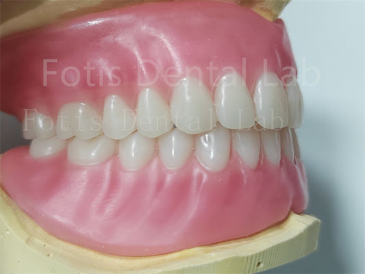 ฟัน Ivoclar โปรเทสต์ฟันครบอาคริลิค ทําความสะอาดง่าย ทนทานสูง