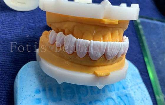 สายมงคลฟันดิจิตอลที่พัฒนามีการปลูก สายมงคลฟันดิจิตอลที่ได้รับการรับรองจาก FDA/ISO/CE