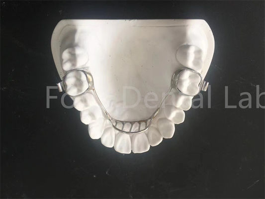 ปรับปรุงการขยายตัวตัวประกอบ Palatal Expander Retainer การบํารุงรักษาง่าย