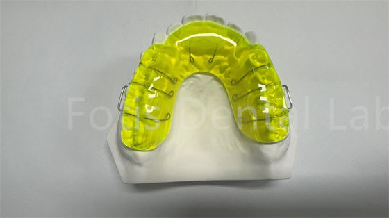ปลอดภัย Miechigan Retainer Expander / อุปกรณ์ระยะทาง Orthodontic สะดวก