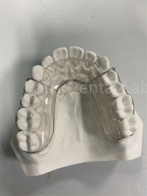 เครื่องยึดฟันที่มีประสิทธิภาพ เครื่องขยายฟัน ที่ปลอดภัย ที่หลากหลาย และทนทาน