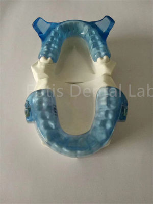 อุปกรณ์ Orthodontics ที่ทันสมัย สําหรับผลการจัดสรรฟันที่ดีกว่า