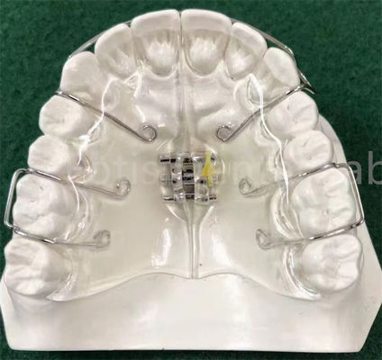 อุปกรณ์ Orthodontics ที่ทันสมัย ที่สามารถขยายตัวได้