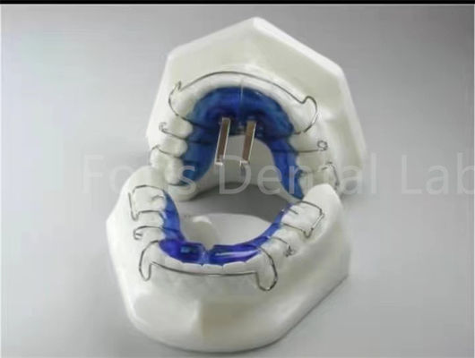 การรักษาเส้นฟัน Orthodontic การขยายตัวสําหรับการปรับเส้นฟันให้ถูกต้อง