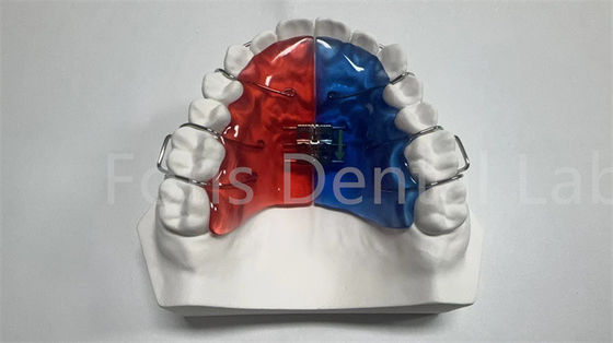 เครื่องขยายฟันแบบออร์โตธอนติกส่วนตัว สําหรับการแก้ไขฟันและการปรับปรุงฟัน