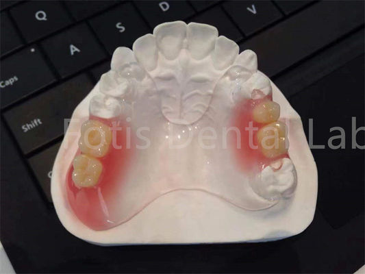เครื่องใช้ฟัน TCS Valplast แบบยืดหยุ่น