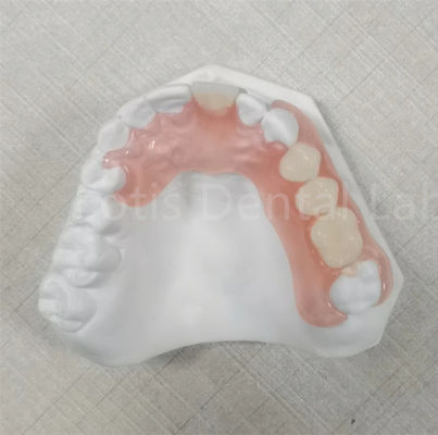 สีชมพู / ใส TCS Valplast ยอมต่อกลิ่น โปรเทสฟันยืดหยุ่น