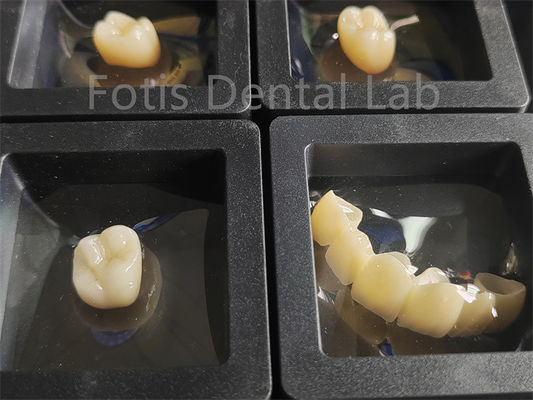 การฟื้นฟูฟัน Zirconia ความทนทานต่อการหักหลายชั้น