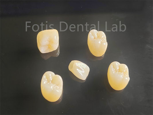 สวยงาม โปรเซลีนเต็มชั้น Zirconia ที่เหมาะสมสําหรับสะพานมงกุฎ