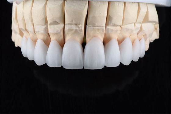 ความทนทานต่อการแตก Zirconia Multilayer Ceramic การแก้ไขสุดยอดสําหรับประสิทธิภาพอุตสาหกรรม