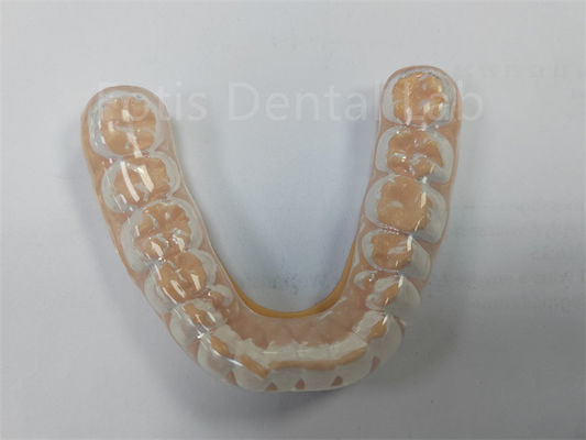 Professional Hard Soft Night Guard Keep Your Teeth Healthy การป้องกันฟันที่แข็งแรง