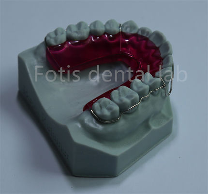 การขยายเครื่องยึดเส้นฟัน Orthodontic สบายและมีราคาถูก