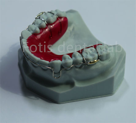 จีน ห้องปฏิบัติการฟัน Retainer ขยายสําหรับการรักษาฟันและการขยาย