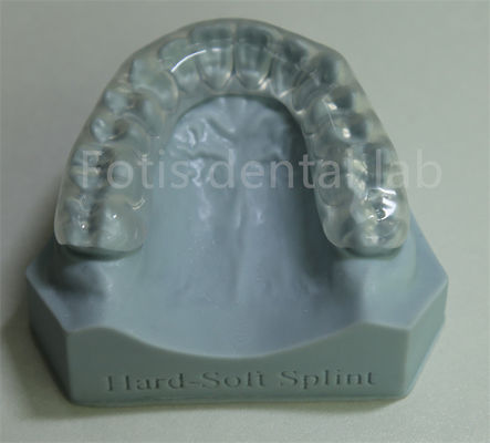 การปรับและปรับแต่ง Orthodontic Retainer Expander สําหรับการยึดยึดและขยายฟัน
