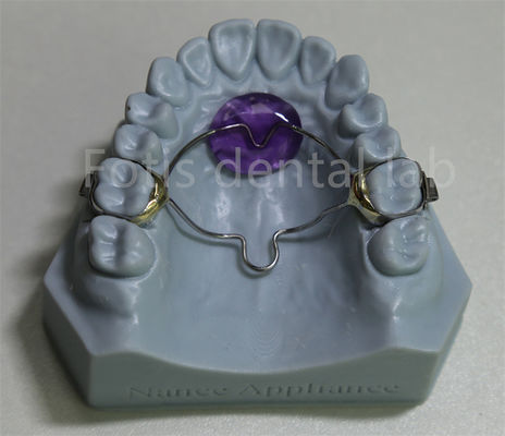 ห้องปฏิบัติการทันตแพทย์ ราคาถูก เครื่องขยายฟัน Orthodontic Expander Retainer มีประสิทธิภาพในการรักษาและขยายฟัน