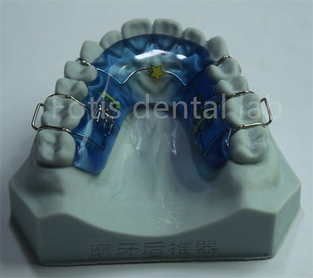 อุปกรณ์ขยายฟันทางฟัน Orthodontic ที่ใช้ได้หลายแบบ เพื่อฟันที่ยั่งยืน