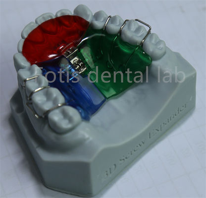 เครื่องขยายฟัน Orthodontic ที่สามารถปรับแต่งและปรับได้ เพื่อรักษาฟันได้อย่างมีประสิทธิภาพ
