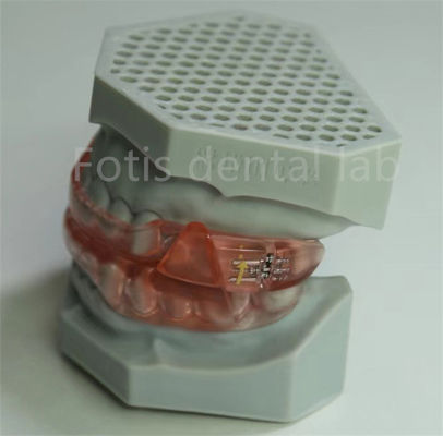 ราคาถูก ห้องปฏิบัติการฟัน Hyrax Expander การรักษาฟัน Orthodontic ถังง่ายที่จะทําความสะอาดและดูแล